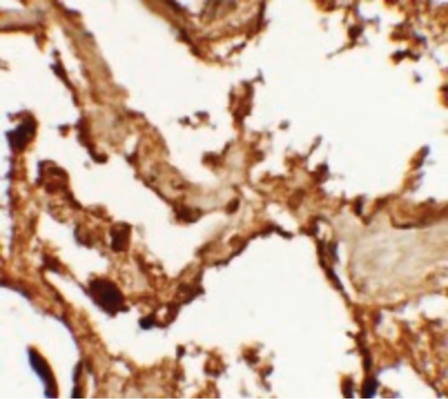 VKORC1 Antibody