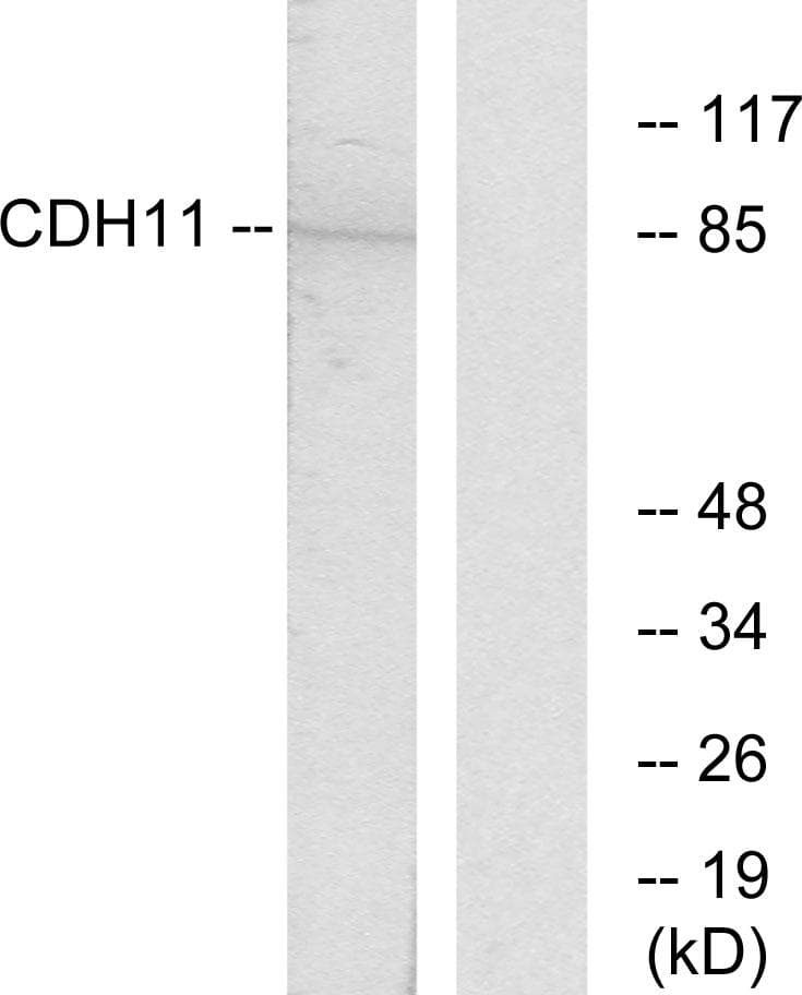 Polyclonal Rabbit anti-Human CDH11 / Cadherin 11 Antibody (WB)