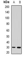 Polyclonal Rabbit anti-Human TSPAN20 / UPK1B Antibody (WB)