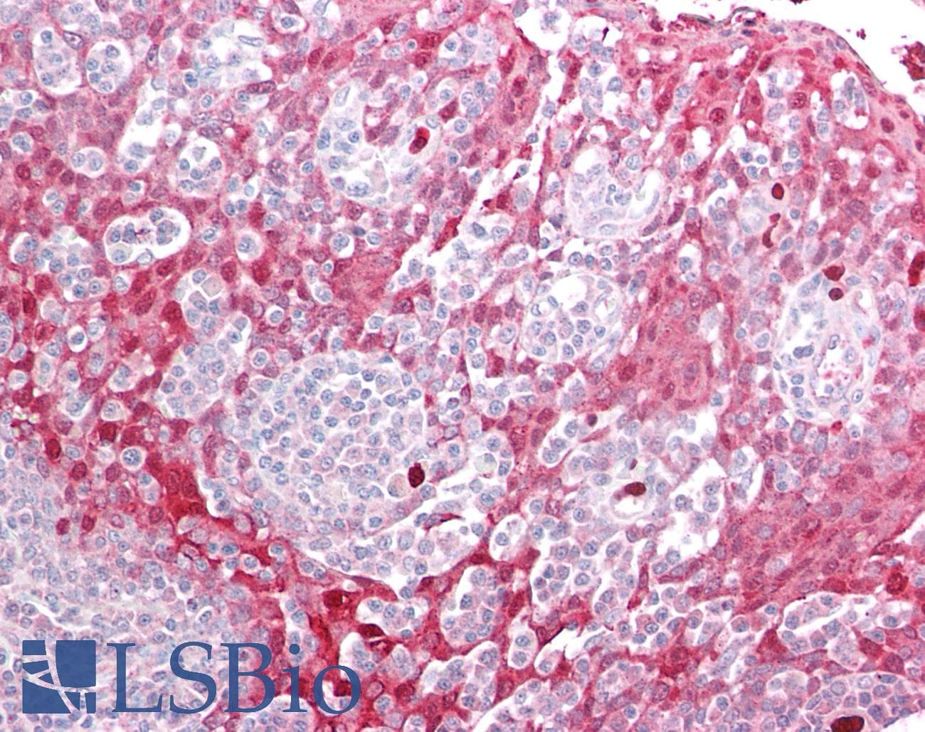 Polyclonal Rabbit anti-Human KLK8 / Kallikrein 8 Antibody (IHC, WB)
