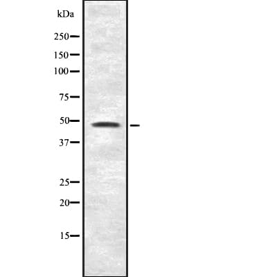 IP6K2 Antibody