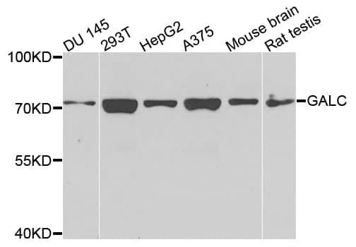 GALC / Galactocerebrosidase Antibody