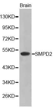 Polyclonal Rabbit anti-Human SMPD2 Antibody (IHC, WB)
