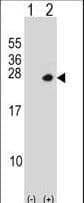 Polyclonal Rabbit anti-Human PSMD10 / Gankyrin Antibody (aa184-213, WB)