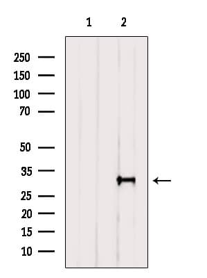 Polyclonal Rabbit anti-Human GSTZ1 Antibody (IF, WB)
