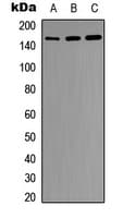 Polyclonal Rabbit anti-Human INSR / Insulin Receptor Antibody (C-Terminus, IHC, IF, WB)