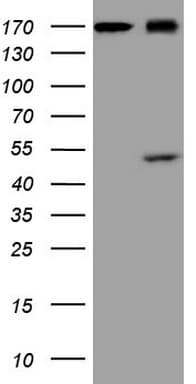 REN / Renin 1 Antibody (aa131-406, clone OTI2A2)