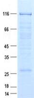 Human TTC16 Protein (Recombinant GST, N-terminus + His, C-terminus)