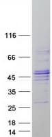 Human FBXO31 Protein (Recombinant Myc-DDK (Flag))