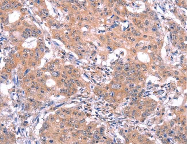 GABRA1 Antibody
