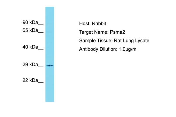 PSMA2 Antibody (aa122-171)