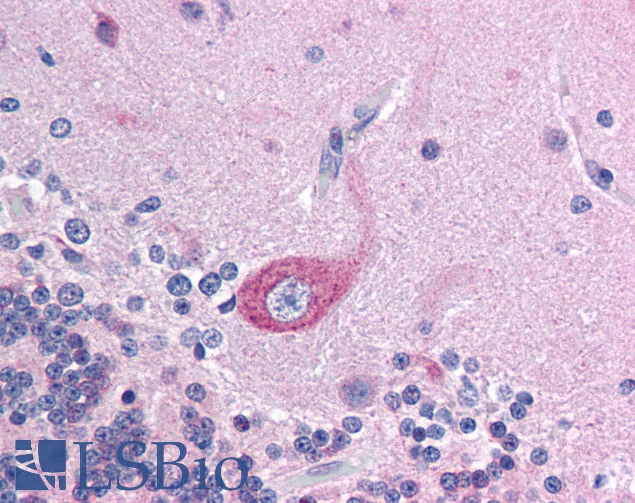 BRD4 Antibody (aa651-700)