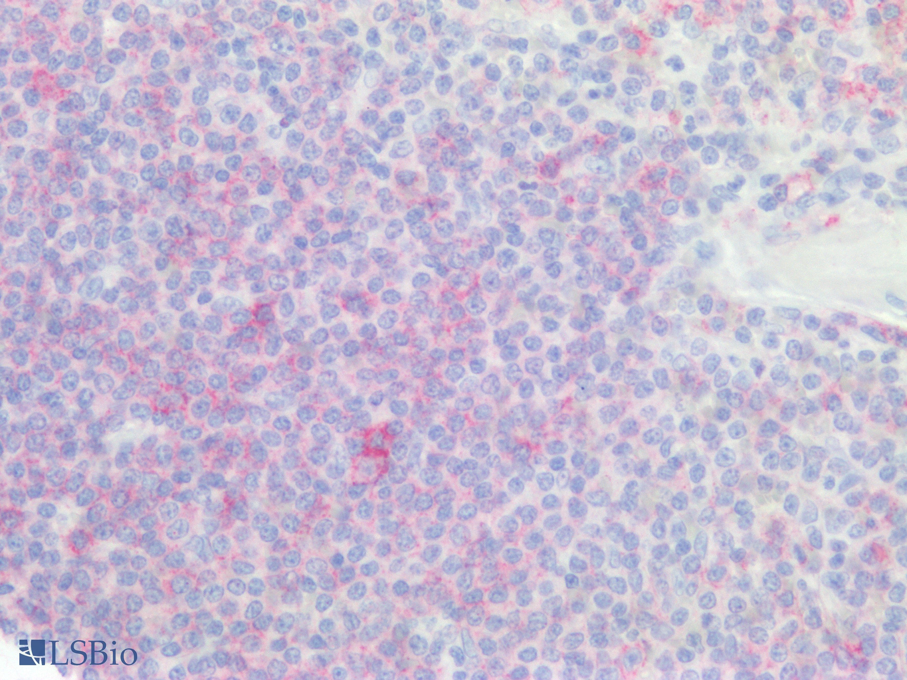PathPlus™ CD20 Antibody