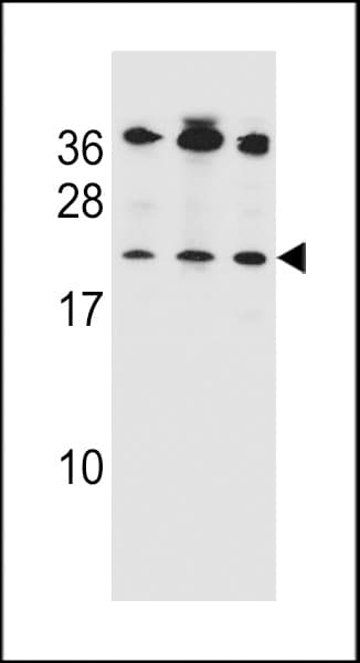 IHC-plus™ BAK1 / BAK Antibody (aa56-91)