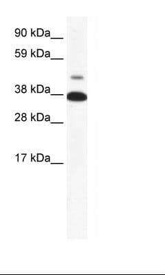 NR1A2 / THRB Antibody (aa37-86)