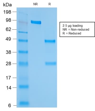 IHC-plus™ HSPD1 / HSP60 Antibody (clone rGROEL/780)