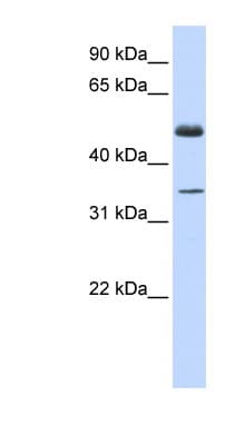Polyclonal Rabbit anti-Human ZNF223 Antibody (C-Terminus, WB)