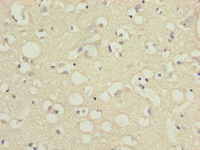 Polyclonal Rabbit anti-Human SLC6A6 / Taurine Transporter Antibody (IHC, WB)