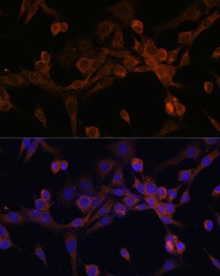 Polyclonal Rabbit anti-Human EIF2B2 Antibody (IHC, IF)