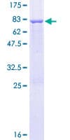 Human ADSSL1 Protein (Recombinant GST)