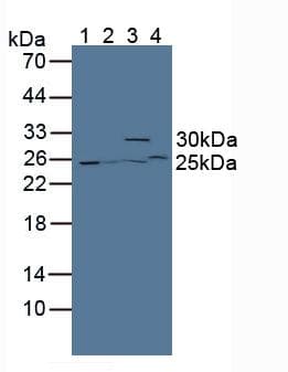 GSTT2 Antibody (aa15-216)