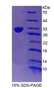 Human CD1E Protein (Recombinant His-T7)