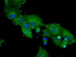 IHC-plus™ DPP4 / CD26 Antibody (clone 11D7)
