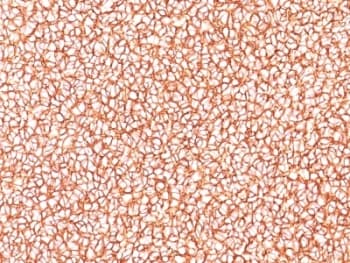 CD99 Antibody (clone SPM586)