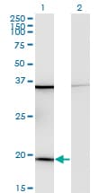 RPL17 / Ribosomal Protein L17 Antibody (clone 3G11)