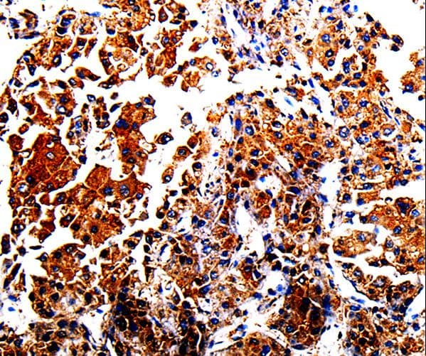 Alpha-Fetoprotein Antibody