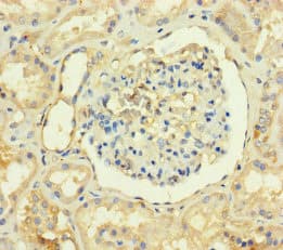 Polyclonal Rabbit anti-Human TMEM82 Antibody
