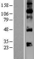 VEGFA / VEGF Protein (Over-Expression Lysate Myc-DDK (Flag))
