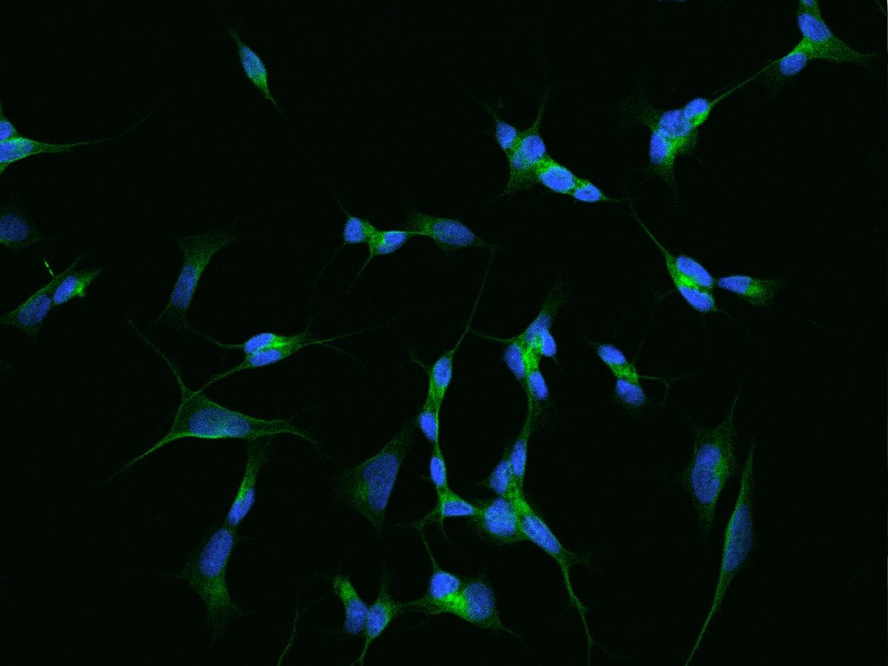 NLGN3 / Neuroligin 3 Antibody