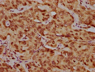 HIST1H1C Antibody