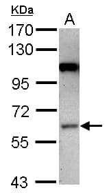 Polyclonal Rabbit anti-Human MAP3K3 / MEKK3 Antibody (Internal, IHC, WB)