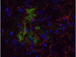 APP / Beta Amyloid Precursor Antibody