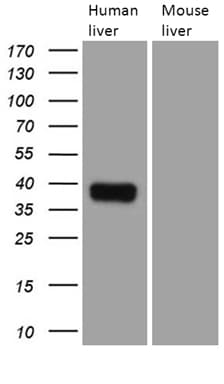 TALDO1 / Transaldolase 1 Antibody (clone OTI4A7)