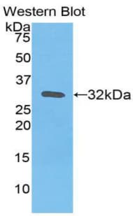 F3 / CD142 / Tissue factor Antibody (aa34-251)