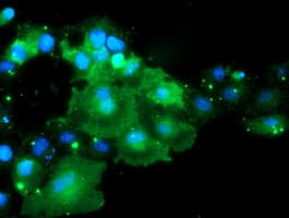 DOK7 Antibody (clone OTI1A9)