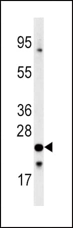 Polyclonal Rabbit anti-Human FXN / Frataxin Antibody (aa143-172, IHC, WB)
