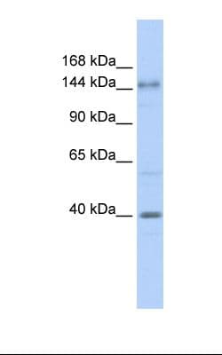 ADCY10 / Adenylate Cyclase 10 Antibody (aa396-445)
