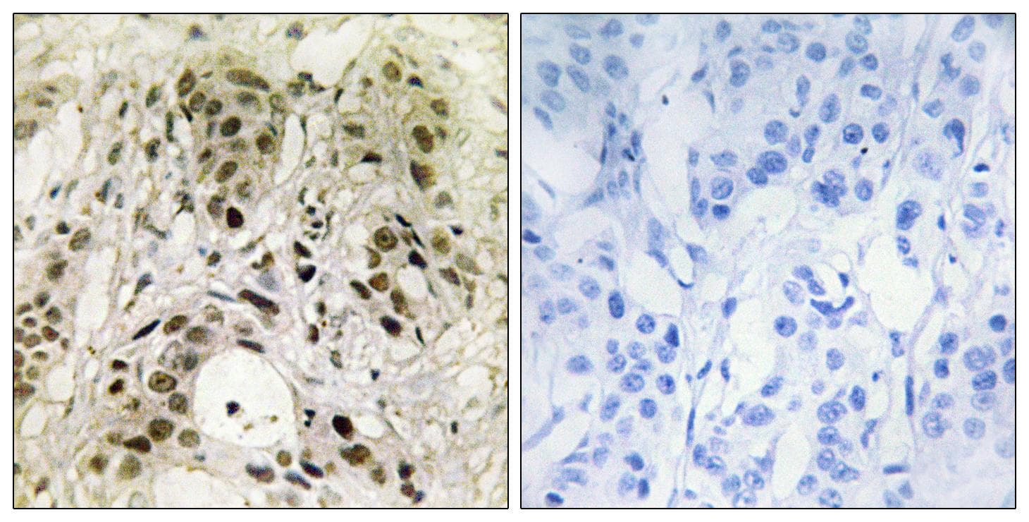 HMGN1 / HMG14 Antibody