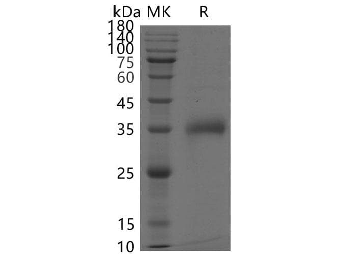Coronavirus SARS-CoV-2 SARS-CoV-2 Spike Glycoprotein (Recombinant His,C-terminus)