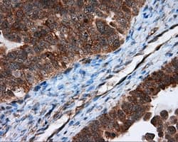 TPMT Antibody (clone OTI2A2)