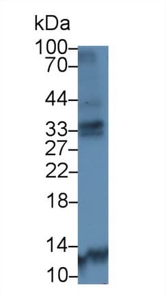 CTSK / Cathepsin K Antibody (aa71-319, Biotin)
