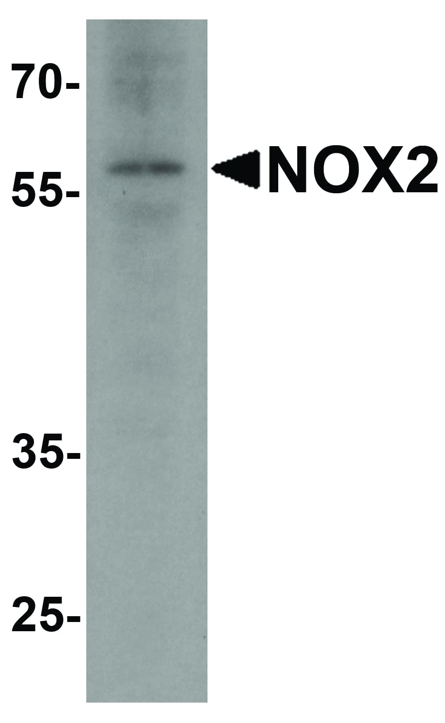 CYBB / NOX2 / gp91phox Antibody