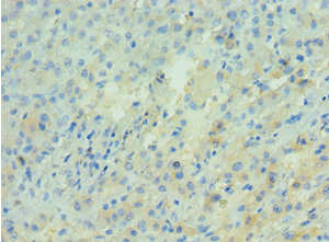APRT Antibody (aa1-180)