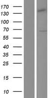 TFB1 / GTF2H1 Protein (Over-Expression Lysate Myc-DDK (Flag))