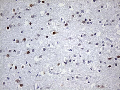 Monoclonal Mouse anti-Human OTX2 Antibody (clone OTI1A1, Carrier-free, IHC, WB)