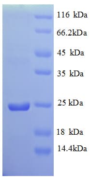 Chicken VAMP7 / SYBL1 / T1 VAMP Protein (Recombinant His)